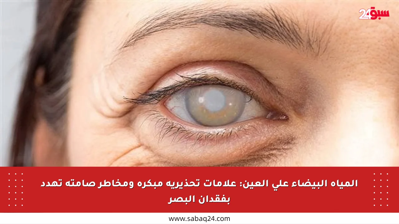 المياه البيضاء على العين: علامات تحذيرية مبكرة ومخاطر صامتة تهدد بفقدان البصر